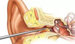 挖耳屎视频,趣味视频带你探索耳道清洁的奥秘